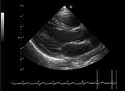 بخصوص فحوص مخطط القلب